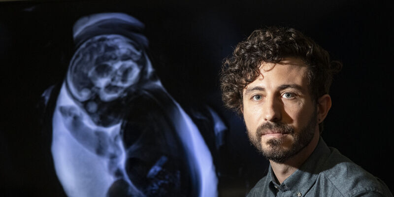Vlad Ayzenberg next to a baby scan