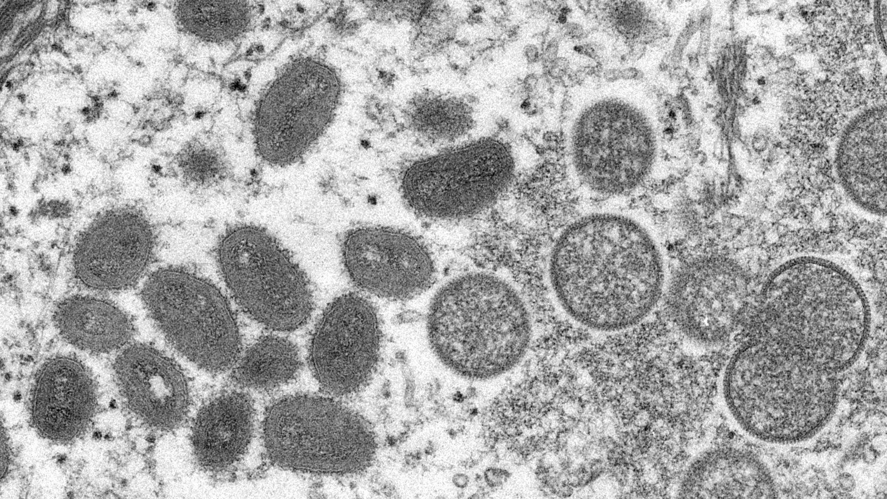 Upclose photo of the monkeypox virus.
