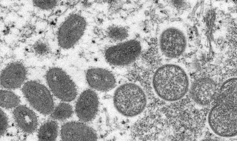 Upclose photo of the monkeypox virus. 