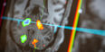 MRI image of the brain