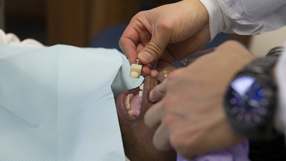 A dentist fitting a tooth crown in a patient's mouth. 